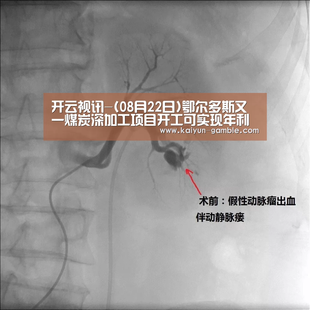 开云视讯-(08月22日)鄂尔多斯又一煤炭深加工项目开工可实现年利润10亿元!(图1) 开云视讯